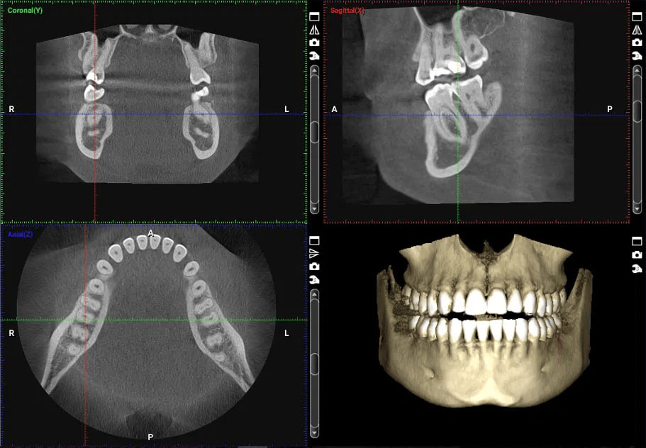 CBCT Scans CBCT Scans